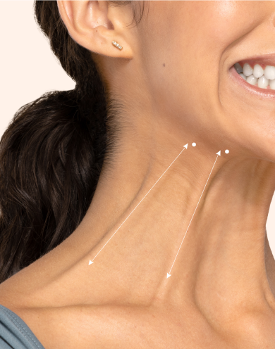 Botox lower face and neck treatment areas